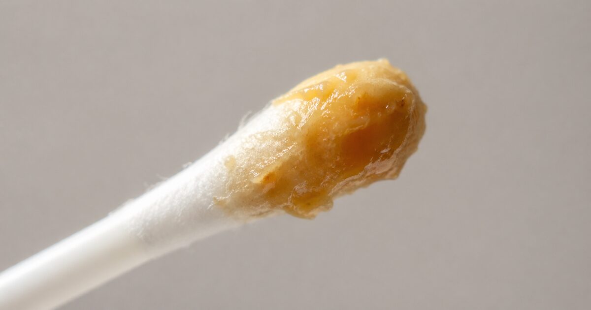 綿棒の先に黄色〜茶色の湿った耳垢がべったり付着している画像