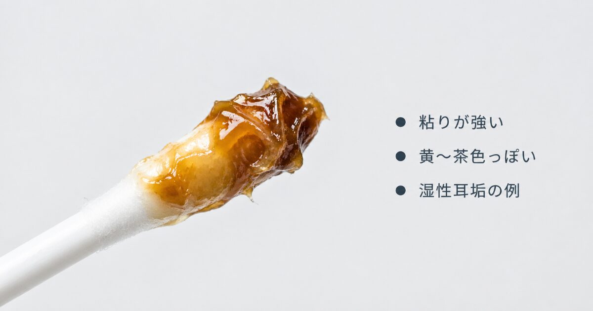 乾いた粉状ではなく、茶色く粘りのあるキャラメル状耳垢の画像